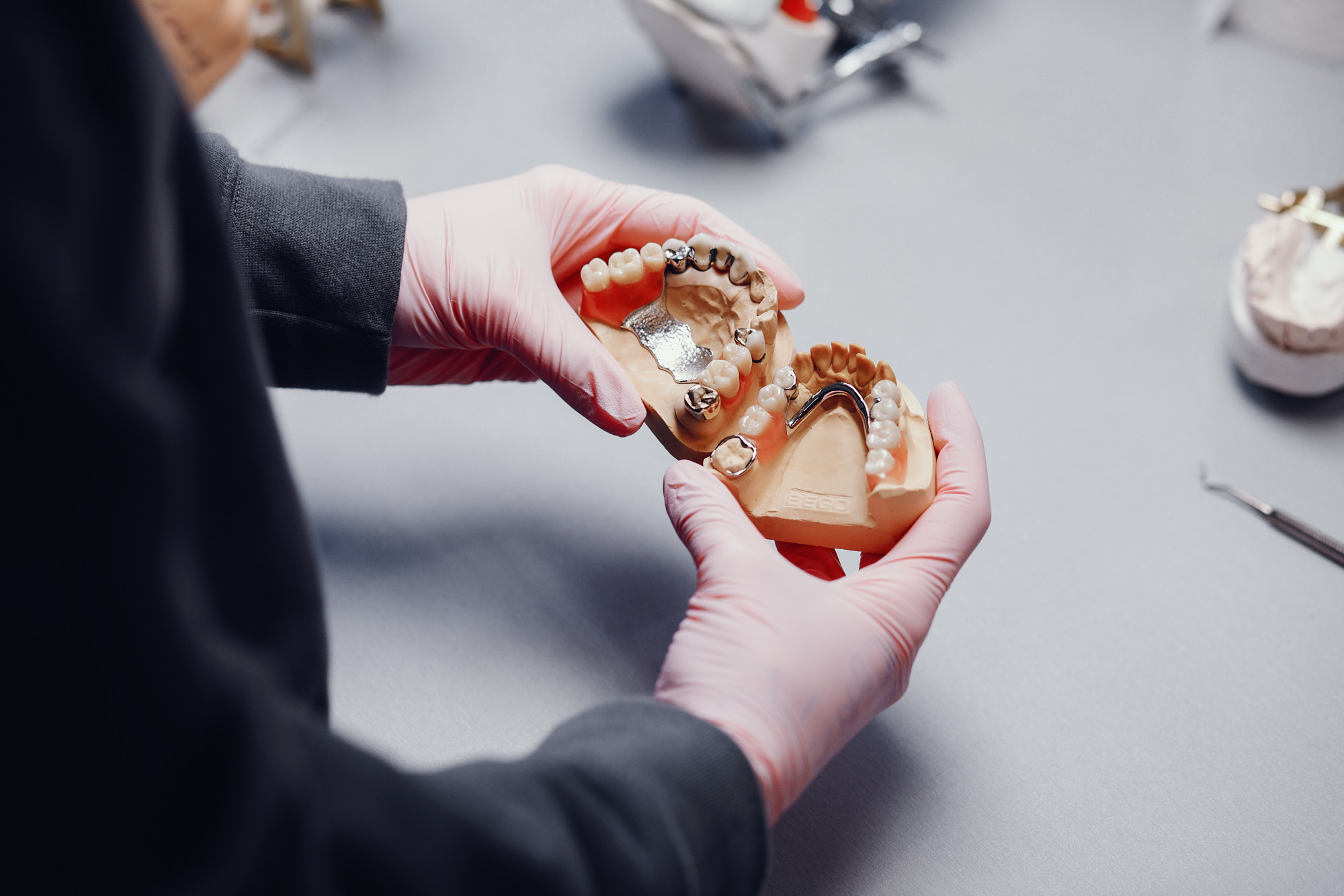 Lost lots of teeth with caries, gum disease